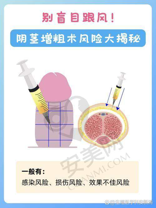 选择广州建国医院增粗手术的理由
