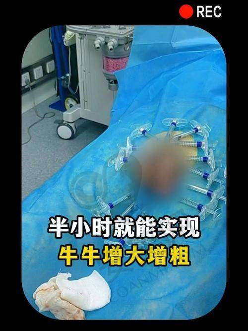 患者的真实实例分享