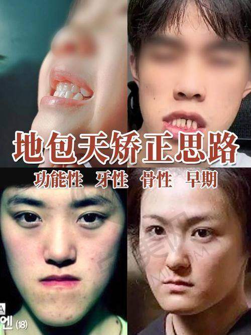 安阳植得口腔医院的具体价格情况