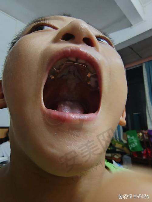 诊疗成效：惊喜与自信