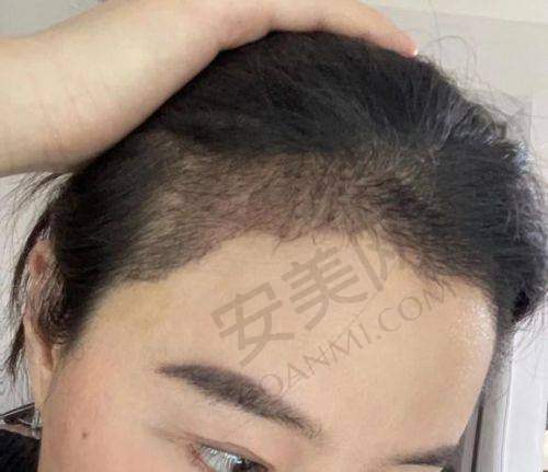 郑州华仁植发刘裴华医生社会职称与荣誉