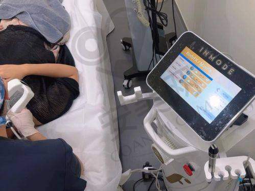 北京丽合射频提升是什么？靠谱吗？
