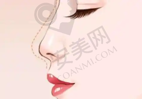 下颌角轮廓整形价格与骨干医生