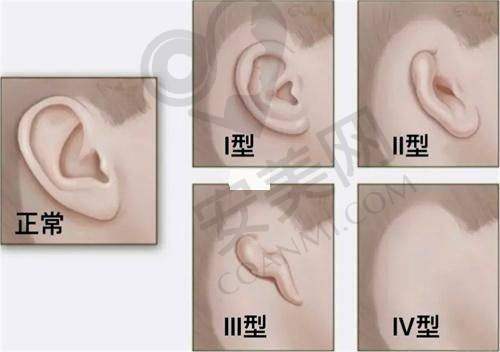 云朵波波胸有什么独特之处？