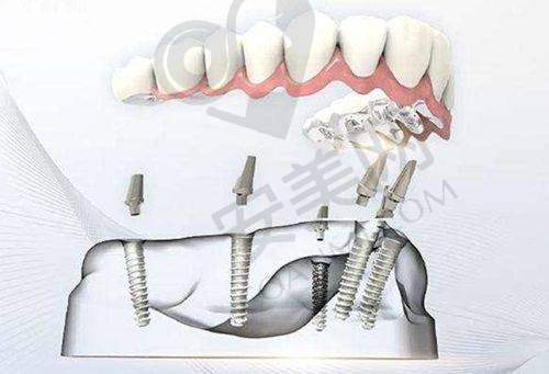 中诺口腔医院整体是国有还是私立？