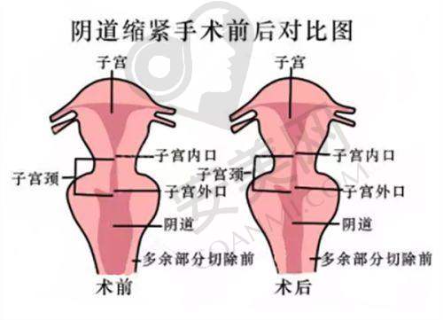 大众对深圳婳美医疗美容医院的评价和口碑
