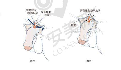 深圳婳美医疗美容医院的背景和发展