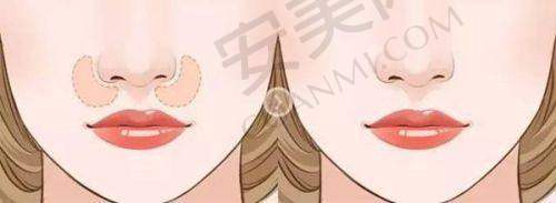 桂林悦莱美整形医院的医生团队水平怎样？
