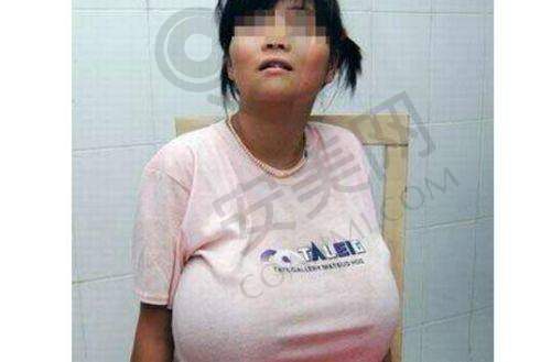 西 南医院整形科