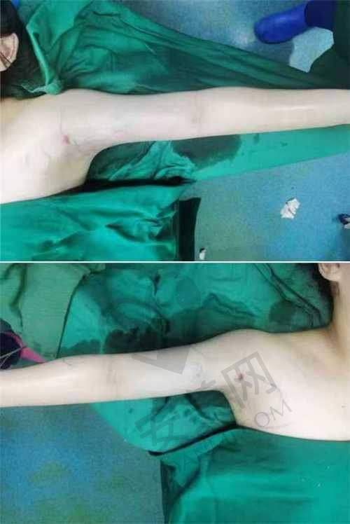 佛山华美：专精医美机构的魅力