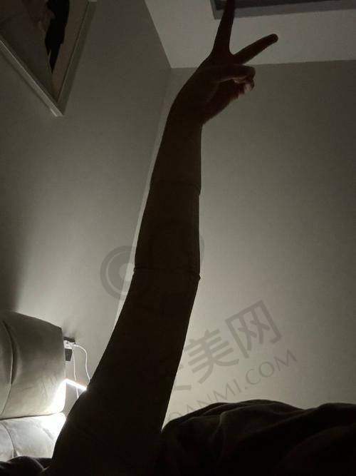 顾客实例：见证手臂吸脂的神奇成效