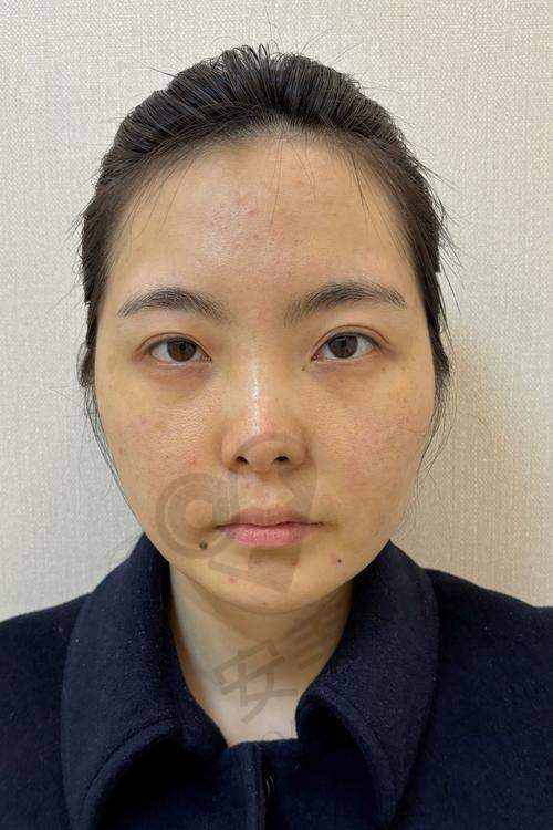 就诊过程是怎样的？