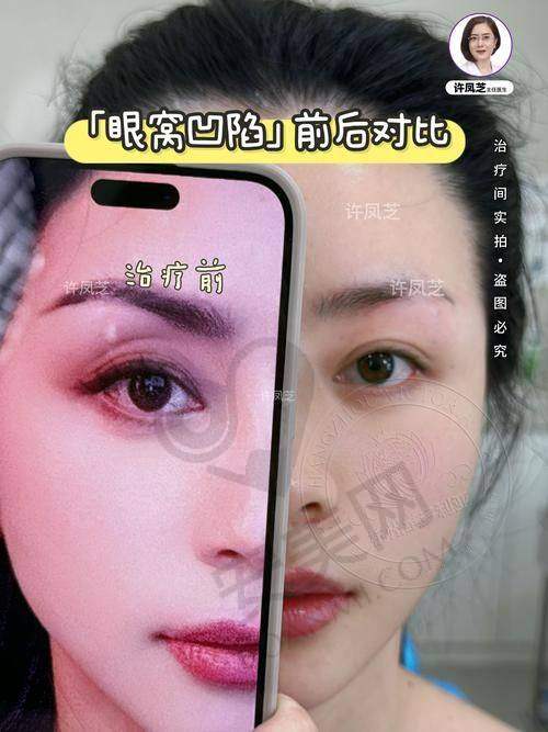 结语