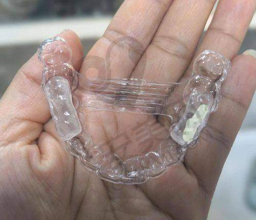 珠海瑞尔口腔韩侑璄医生牙齿矫正怎么样？