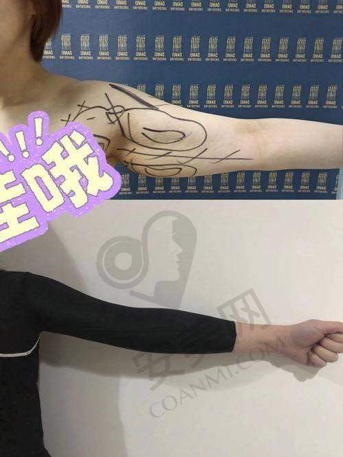 总结
