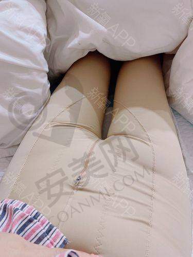 大腿吸脂技术有什么特色？
