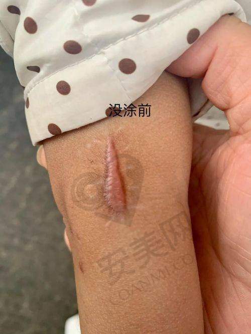 苏州乐桥疤痕研究院的医疗团队实力如何？