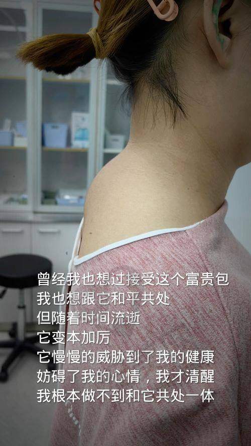桂林悦莱美富贵包微创术的价格是怎样的？