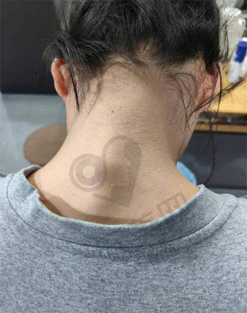 诊疗成效和感受如何？