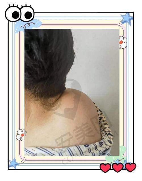 什么是富贵包？它有哪些危害？
