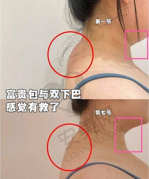 桂林悦莱美毛医生的成功实例有哪些？