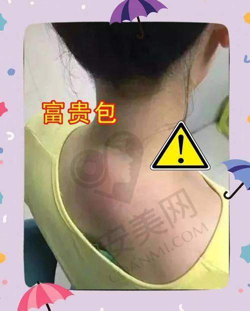 总结：开启健康美丽新征程