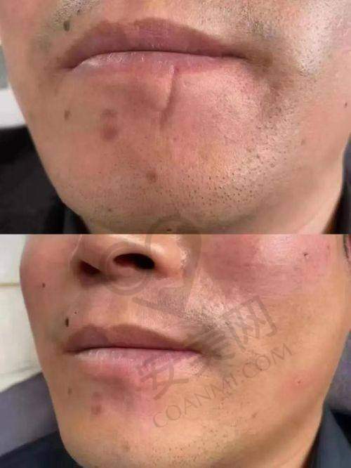 苏州乐桥疤痕研究院是一家怎样的医院？