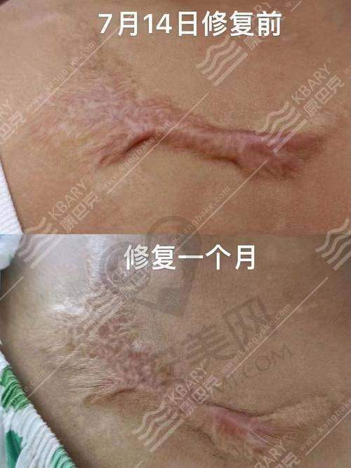 苏州乐桥疤痕研究院的服务质量怎么样？