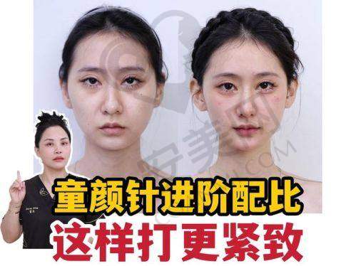 上海美莱整形医院怎么样？