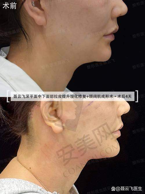 5、上海伯思立倪锋医生患者评价
