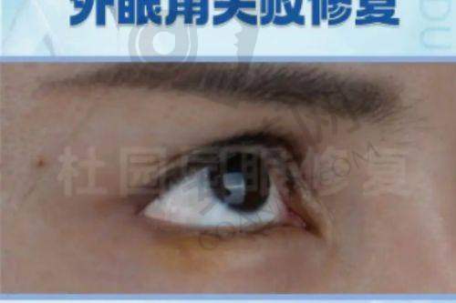 成都艺星整形医院的服务质量如何？