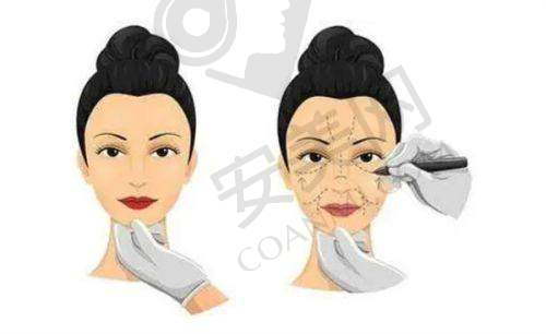 吸脂手术的专精医生