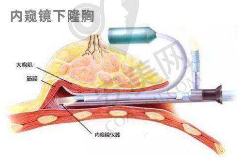 如何在成都艺星和铜雀台之间做出选择？
