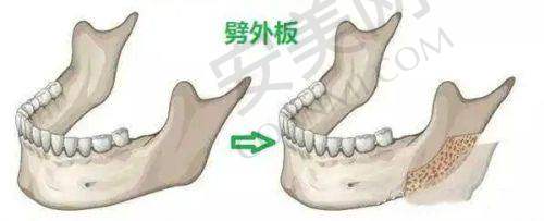 成都艺星和铜雀台的项目价格差异大吗？