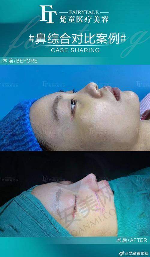 杭州整形医院谭晓燕医生预约挂号指南