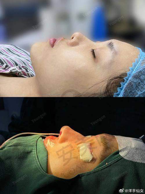 杭州整形医院谭晓燕医生擅长项目