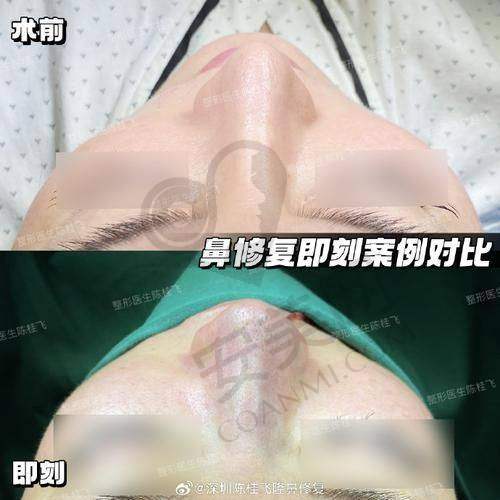 杭州整形医院谭晓燕医生社会职称