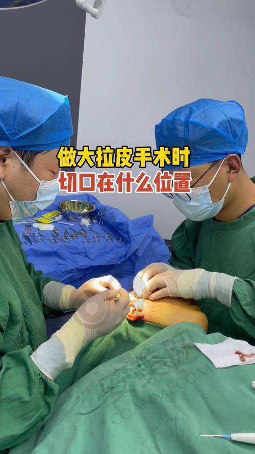 上海伯思立做面部拉皮提升的口碑如何？