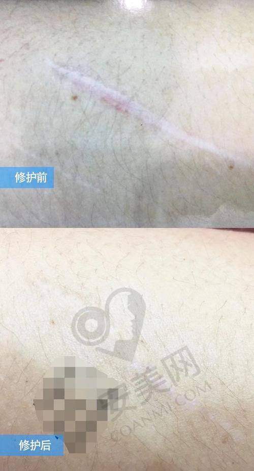 深圳悦尔的医生团队怎么样？