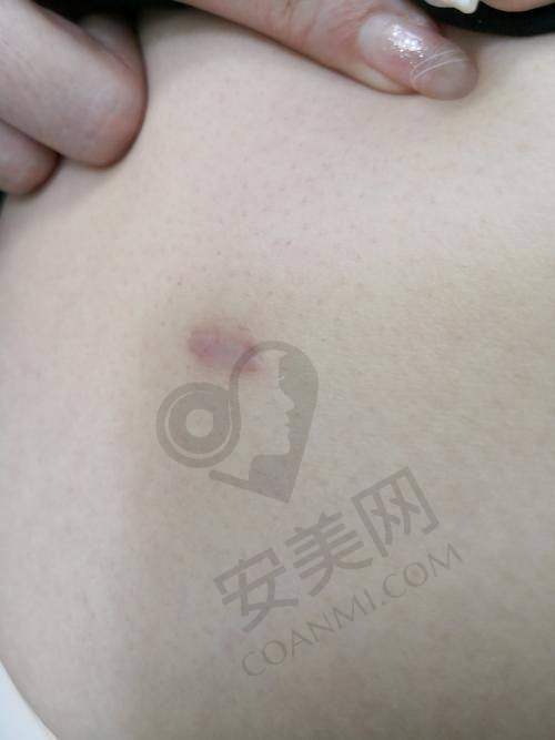 总结：重拾美丽与自信
