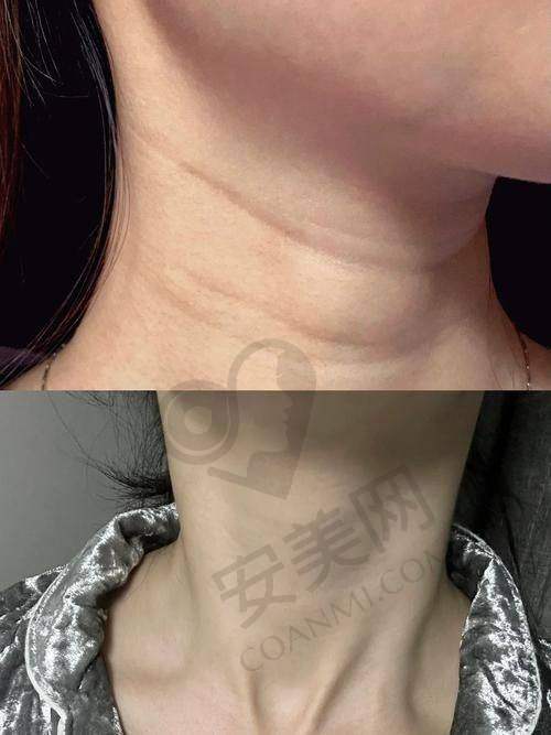 贵阳美莱饶焱院长是谁？