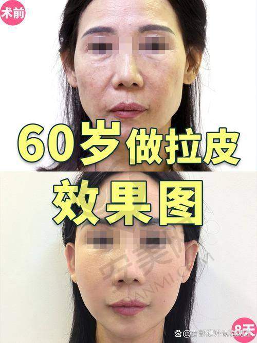 崔昌墉医生是谁？他有何独特之处？