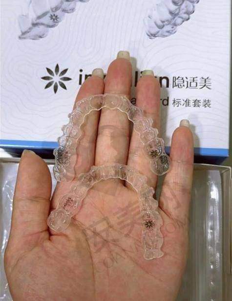 38000元起的价格：包含了哪些内容？