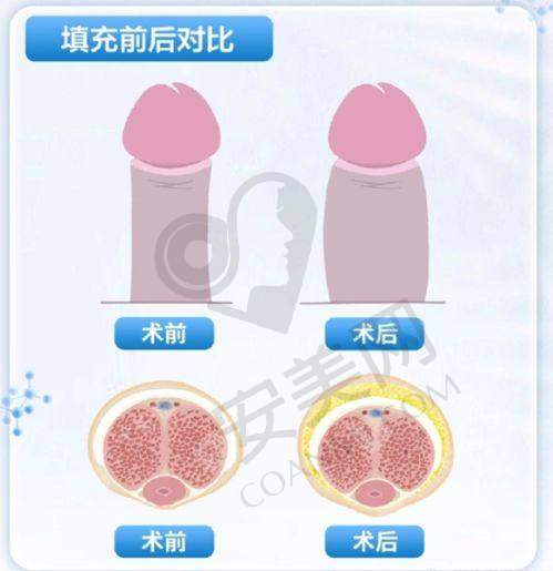 选择佛山曙光金子医院的优势