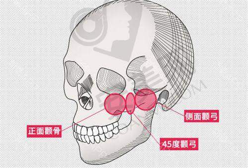 北京黄寺整形医院的术后成效有保护吗？