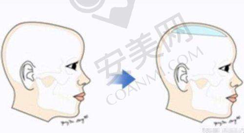 北京黄寺整形医院的骨干医生团队实力怎样？