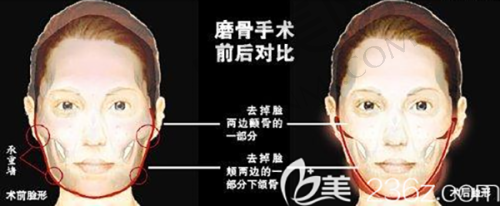 5、潍坊华韩李敏医生患者评价