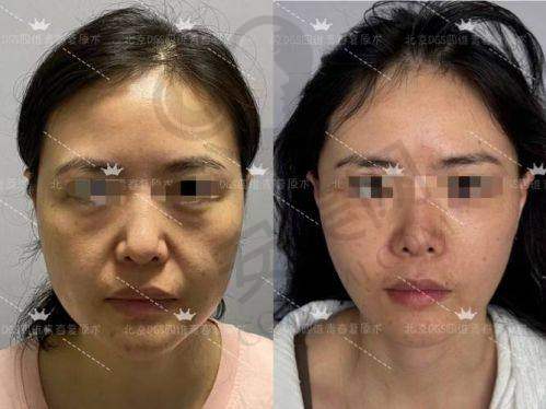 佛山超美整形：简单手术大改善