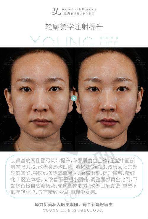 佛山华美整形：多项目综合改善的行家