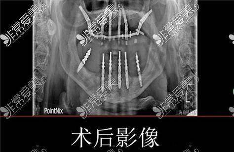 就诊当天的流程是怎样的？